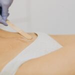 Depilacija bikini predela s sladkorno pasto